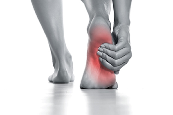 Different Types of Heel Pain